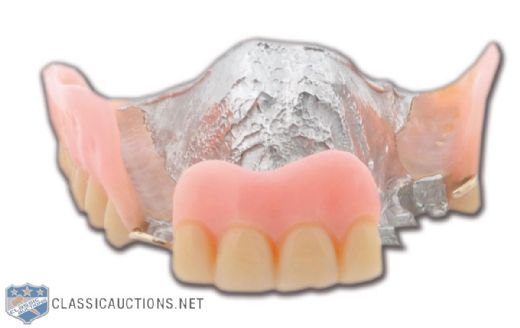 Yvan Cournoyers Partial Dental Plate